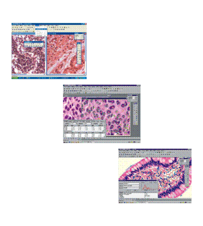 NOVEL      江南永新    ScopeImage Analysis        图像分析软件