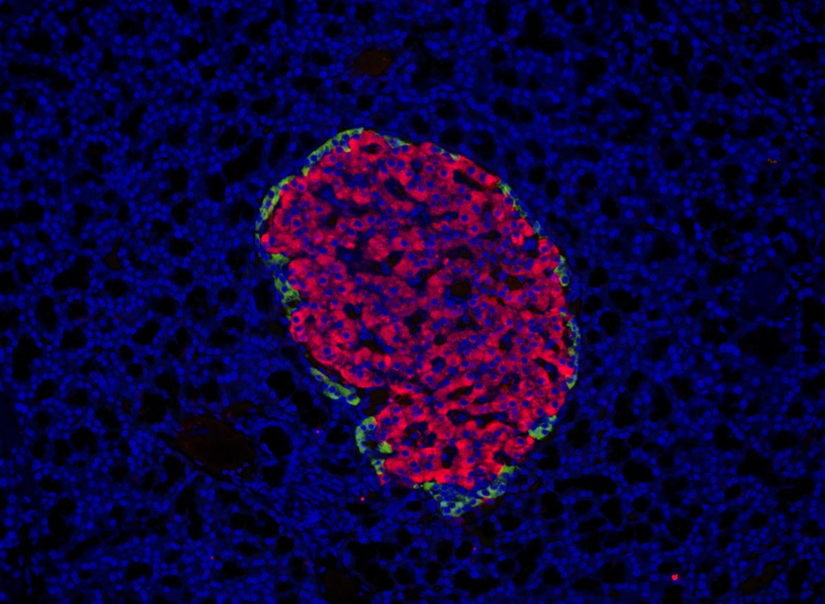 大鼠胰腺。染色:DAPI AF555 Cy5